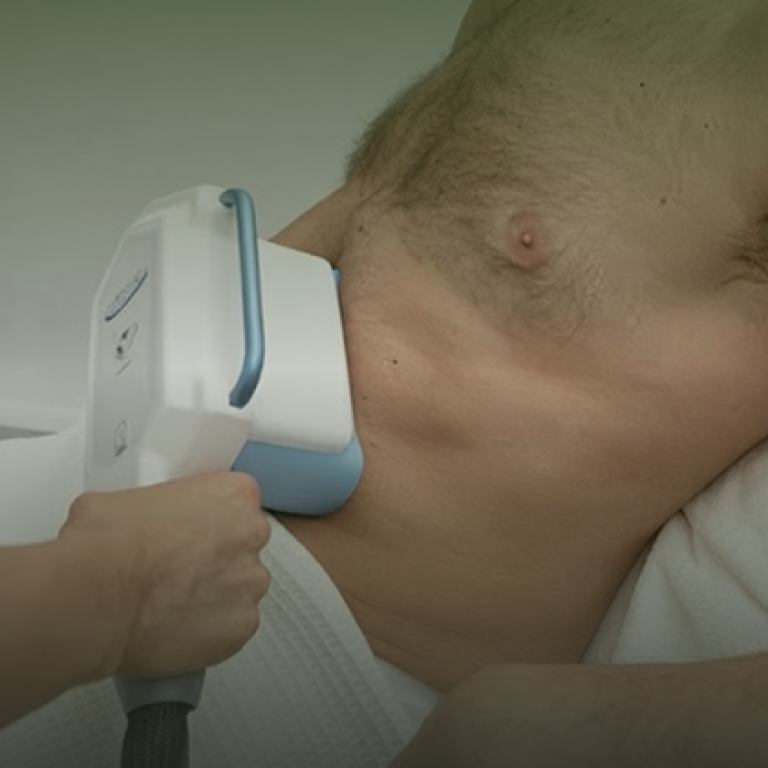 Cryolipolysis (CoolSculpting)