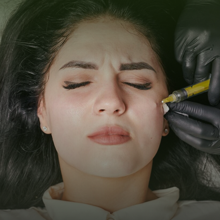PRP for Face
