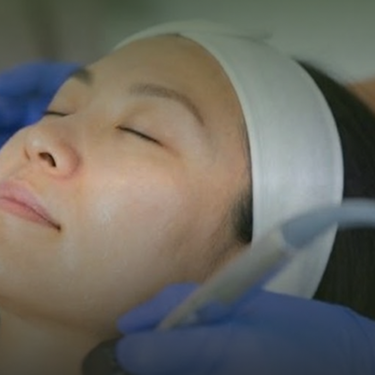 RF Skin Tightening